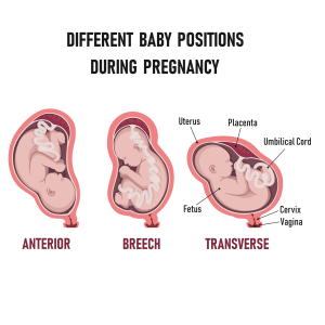 baby positions in womb_273448718